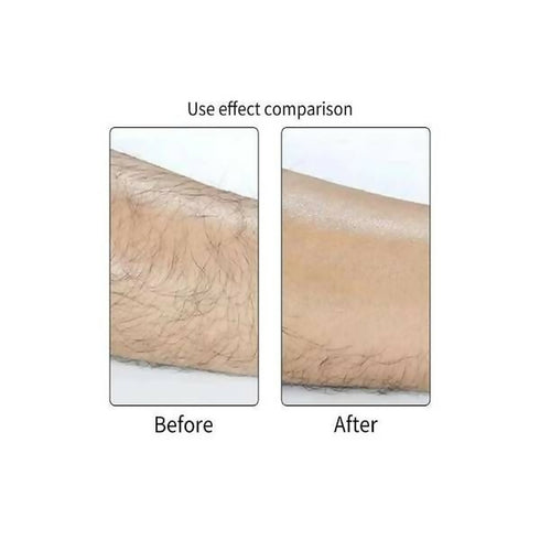 Epilator Painless Hair Removal Exfoliator - Gentle Skin Friendly Full Body - Black