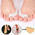 1 Pair Silicone Toe Correctors